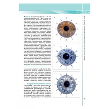 Руководство по иридодиагностике и фитотерапии. Общая иридодиагностика и общая фитотерапия